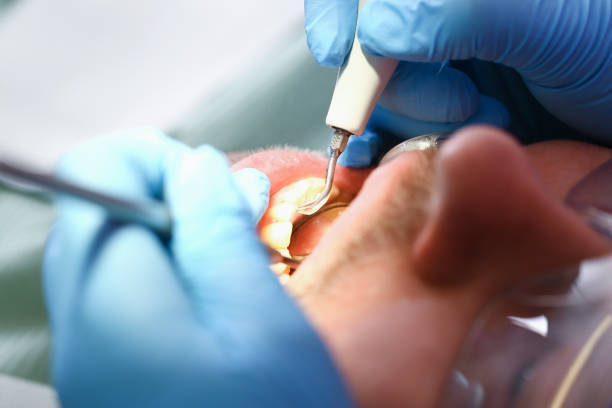Best Emergency Dental Care for Broken or Chipped Teeth in Nes, IL